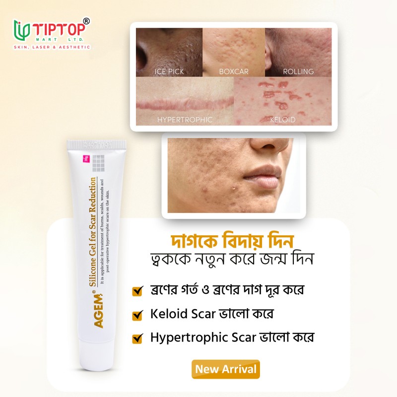 AGEM Silicone Gel 30gm
